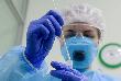 На Кубани зарегистрировано 170 новых заболевших коронавирусом