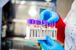 На Кубани за сутки выявлено 174 заболевших коронавирусом